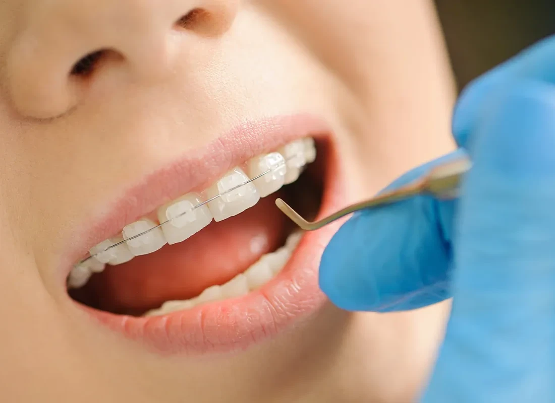 Preventive Dentistry at Delicate Smiles in Milwaukee, WI