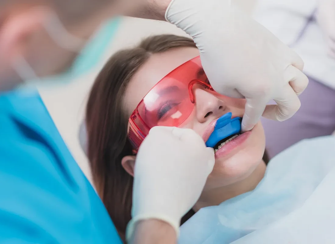 Fluoride Treatments in Milwaukee, WI