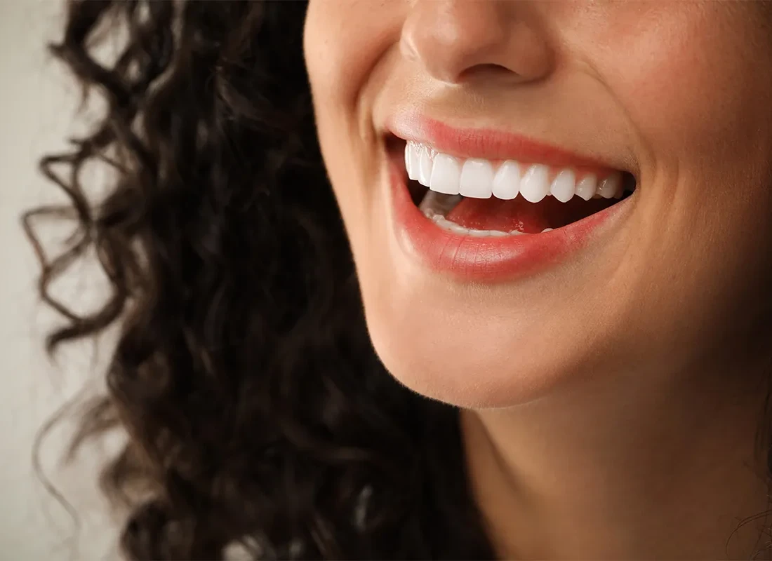 Smile Makeovers at Delicate Smiles
