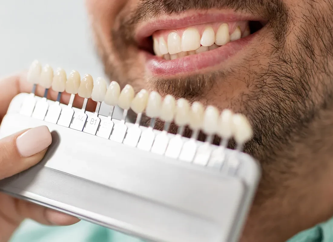 Teeth Whitening in Milwaukee, WI