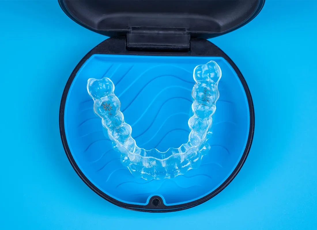 Clear Aligner Therapy at Delicate Smiles