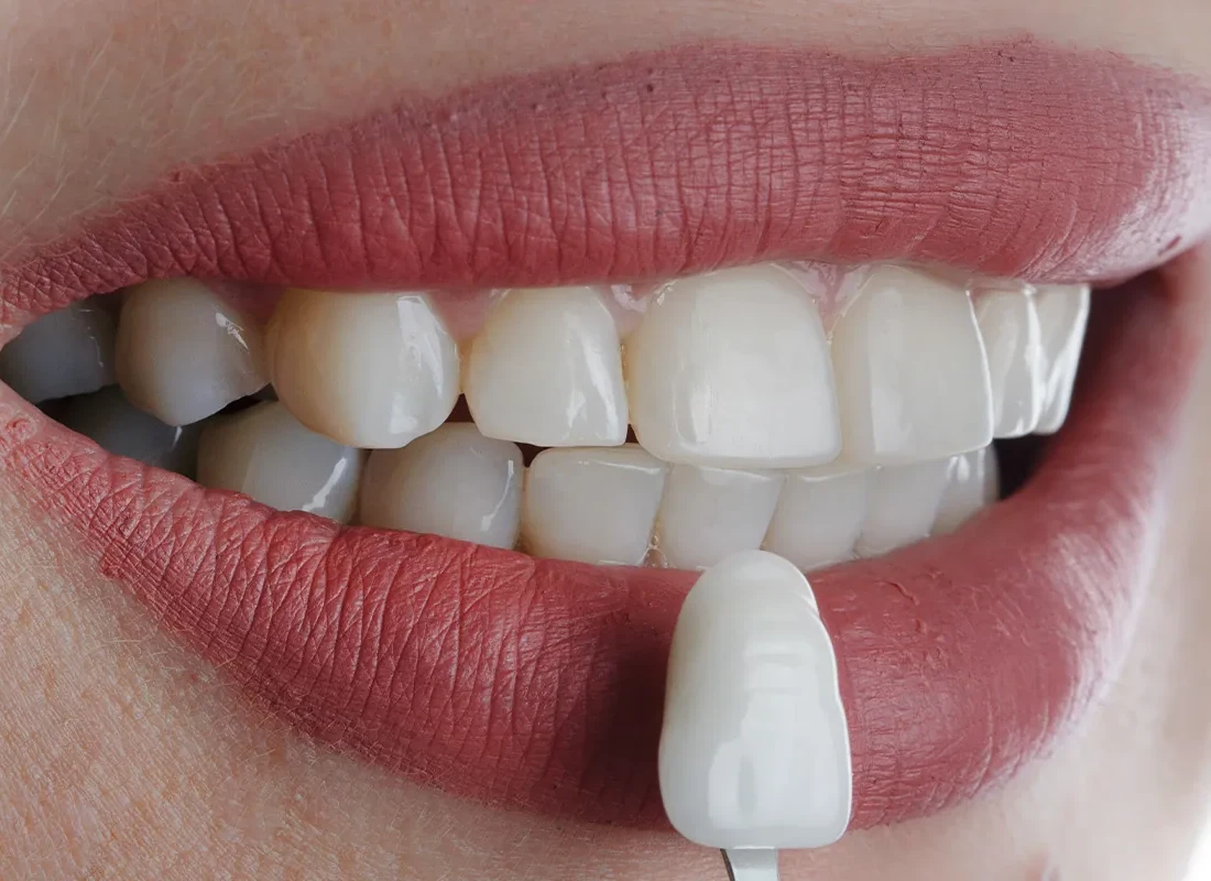 Smile Makeovers in Milwaukee, WI