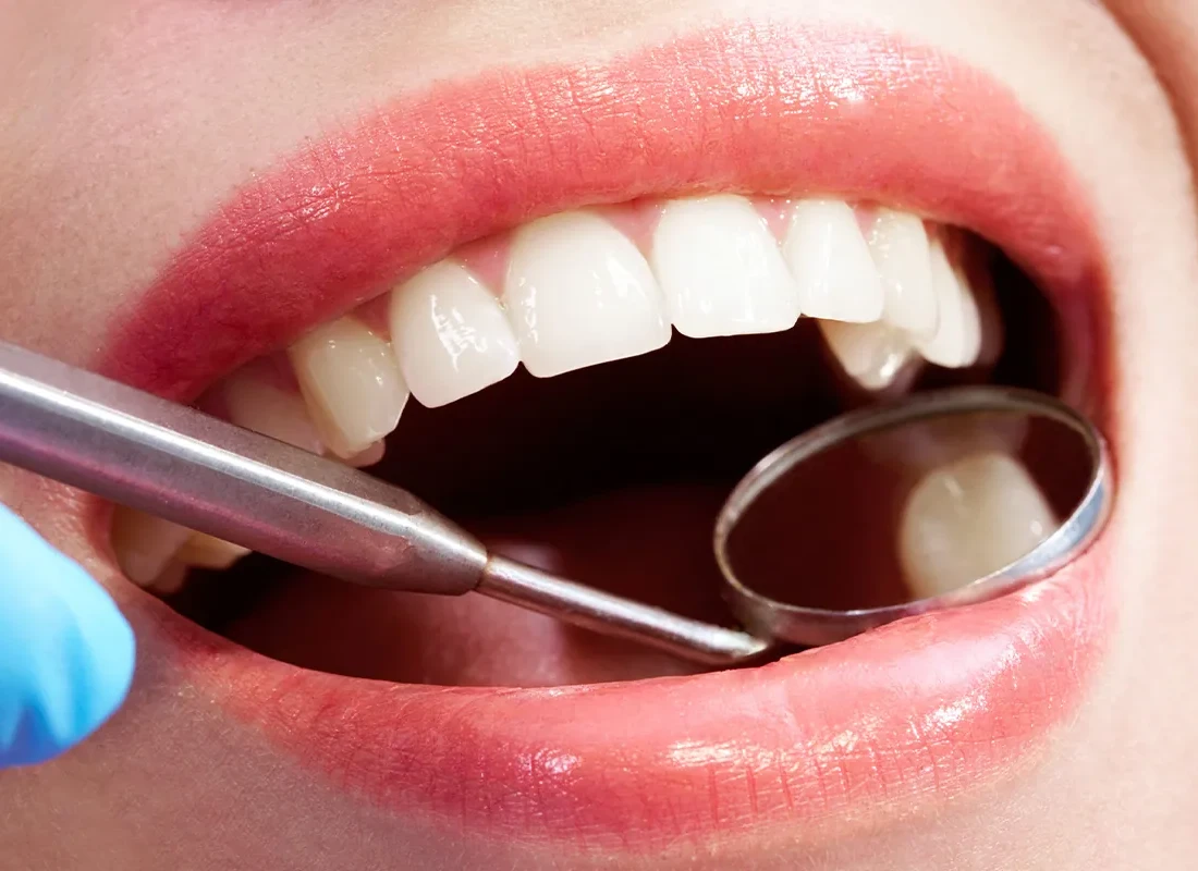 Dental Exams & X-Rays at Delicate Smiles