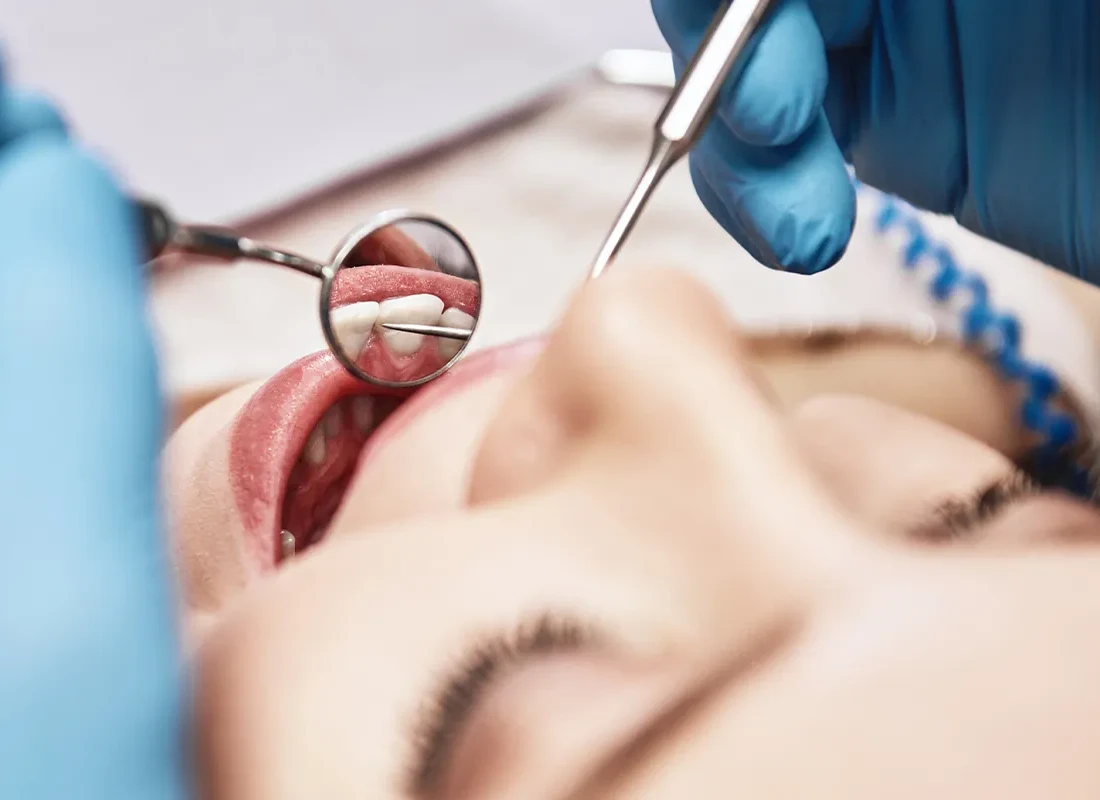 Periodontal Care at Delicate Smiles