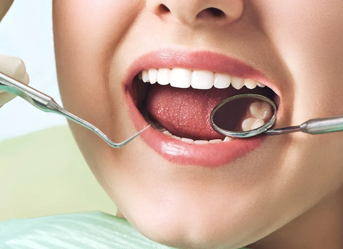 Delicate Smiles dental services