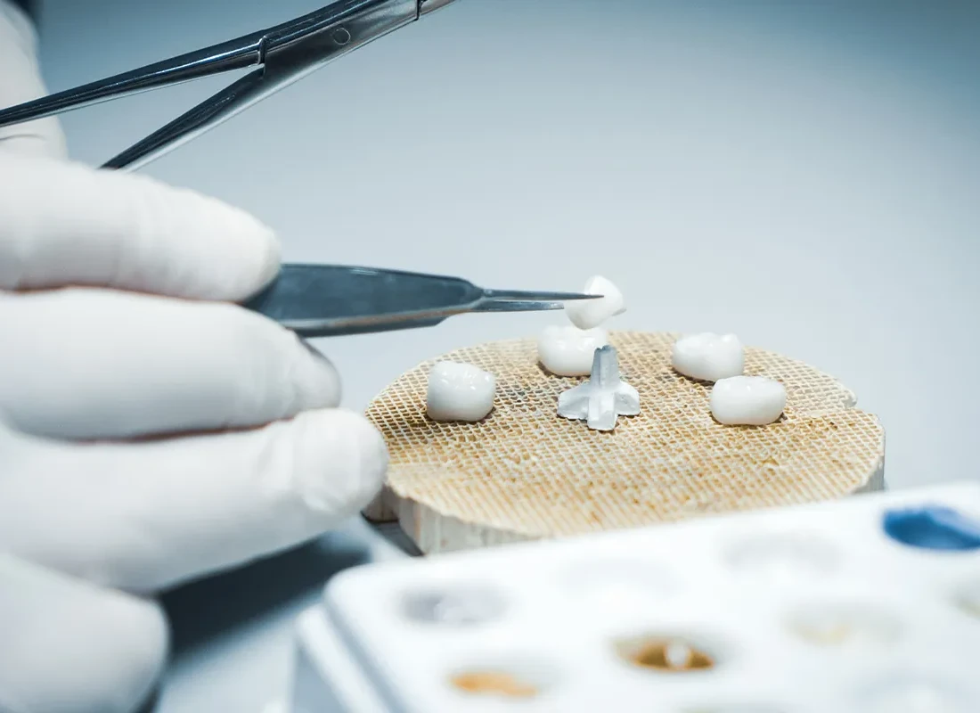 Dental Crowns at Delicate Smiles