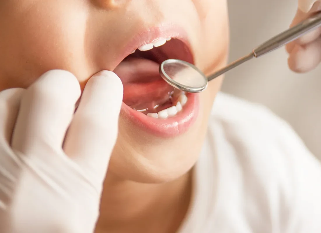 Children's Dentistry at Delicate Smiles