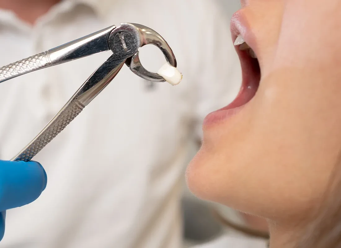 Oral Surgery at Delicate Smiles in Milwaukee, WI