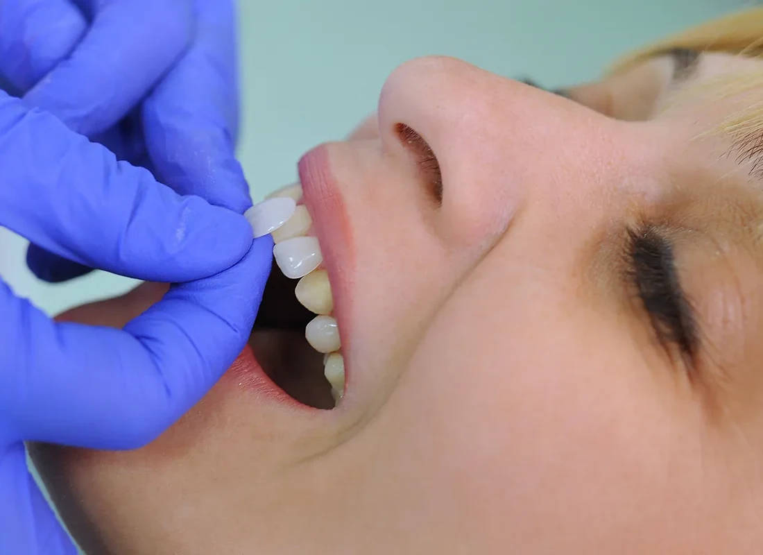 Cosmetic Dentistry at Delicate Smiles